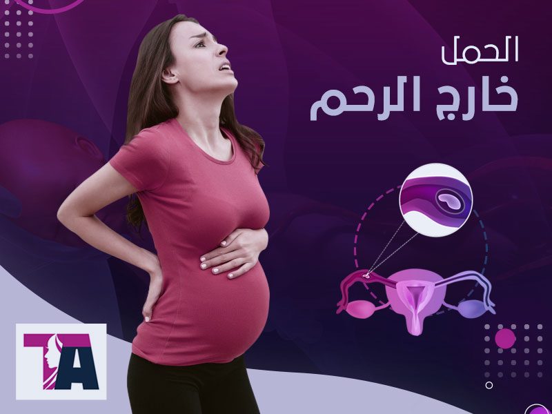 الحمل خارج الرحم اعراضه واسبابه - طارق العزيزي