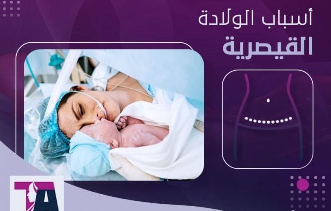 اسباب الولادة القيصرية - د-طارق