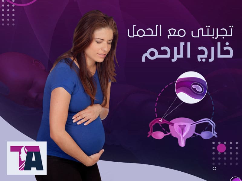 تجربتي مع الحمل خارج الرحم - طارق العزيزي