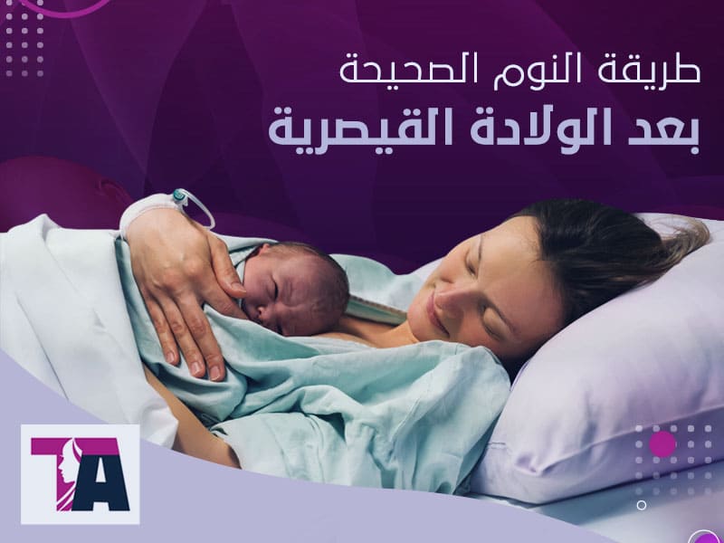 طريقة النوم الصحيحة بعد الولادة القيصرية - د طارق