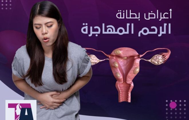 اعراض بطانة الرحم المهاجرة - طارق العزيزي